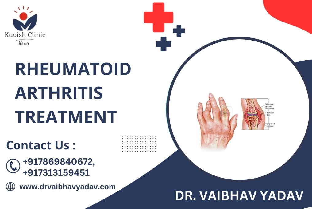 Best Doctor for Rheumatoid Arthritis Treatment in Indore